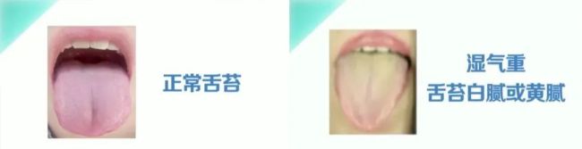 一年中濕氣最重時候來了,！停下這些“加濕”行為