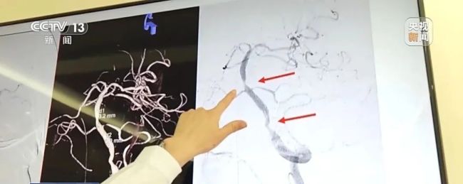 体感温度超40℃！小心“热中风”
