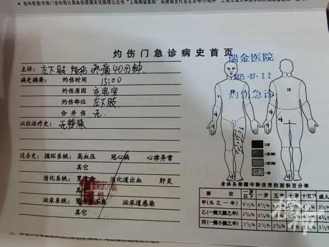 罗马仕充电宝突然起火 25岁小伙烧伤 三级烧伤需植皮手术