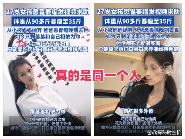 体重仅35斤女生发求助