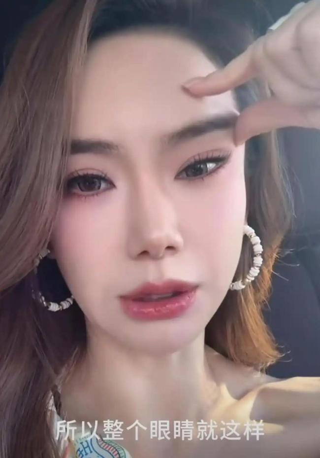 戚薇承认过度医美：打肉毒打僵了 医美翻车现场变脱口秀