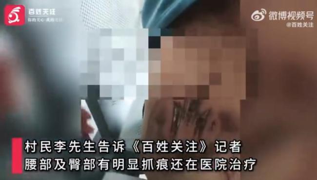 村民说，老虎在做农场工作时刮擦了他们，他们