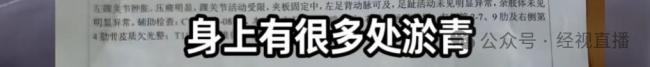 81岁网红外婆“册琳娜”遭遇车祸 网友祈福早日康复