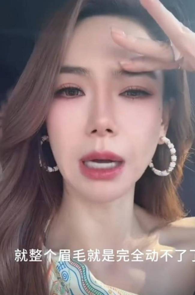 吴昕晒近况被质疑医美过度 脸部状态引争议