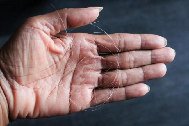 白头发拔一根长三根？到底能不能拔