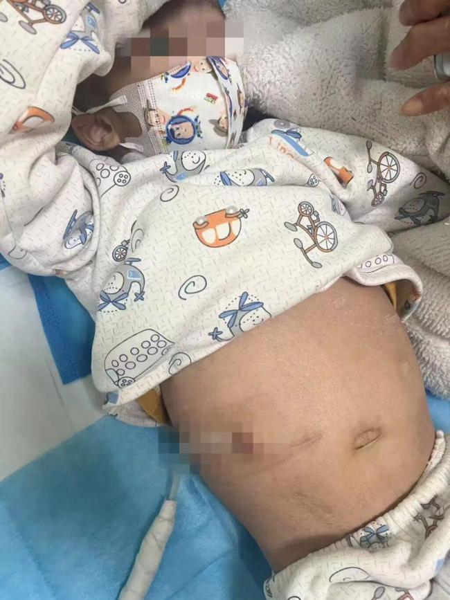 试管婴儿患肾病 父母要求医院担全责