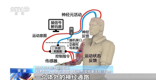 我國腦機接口技術(shù)走向臨床 受試者體驗如何？