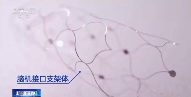 我国脑机接口技术走向临床 受试者体验如何？