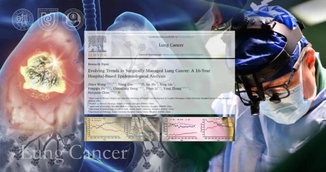 研究:年轻女性肺癌激增 不吸烟者占比飙升