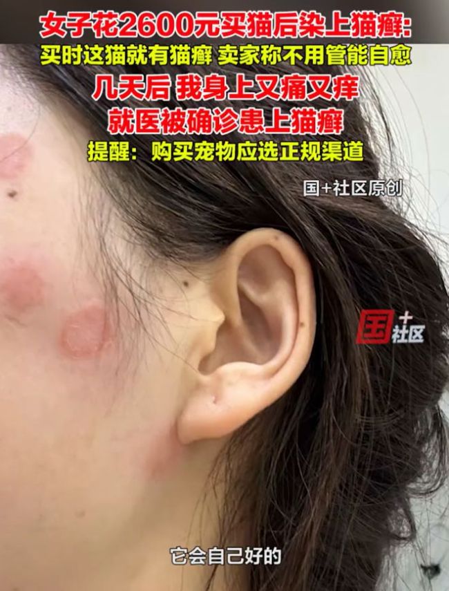 女子2600元买猫被传染满脸猫藓 卖家误导惹祸