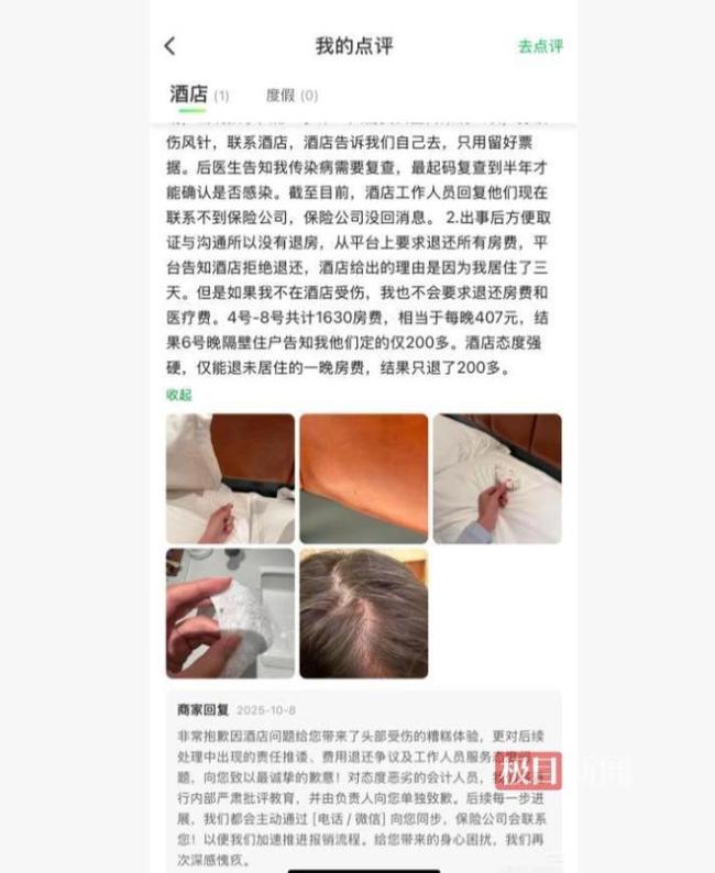 酒店称扎破女子头的钉子来源不明 已安排专人处理