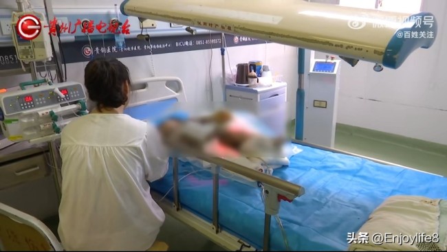2岁女童跌入开水锅特重度烫伤！