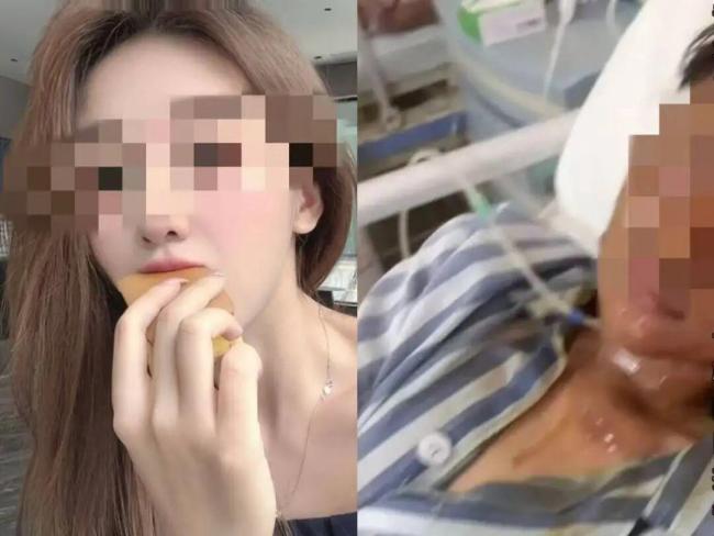 警方回应女主播被快递包裹炸伤 嫌疑人已被抓获