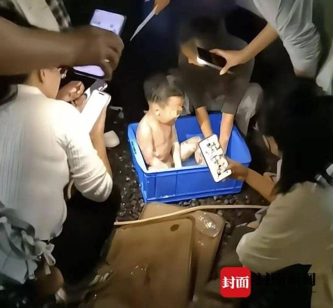 母亲徒手入火救3岁烧伤儿