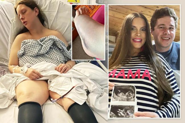 英國(guó)女子流產(chǎn)手術(shù)沒(méi)做好，部分胎兒組織留在她體內(nèi)，致其中毒瀕死