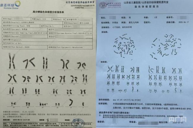 孕检低风险却生下唐氏儿 保险拒赔 理赔条款引争议