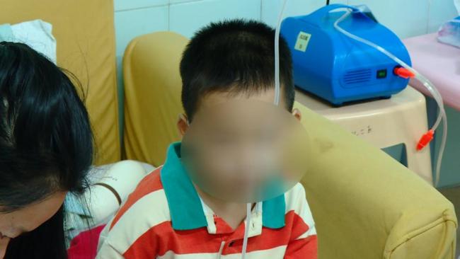 呼吸道合胞病毒进入高发期！“伪装”成普通病毒专盯宝宝