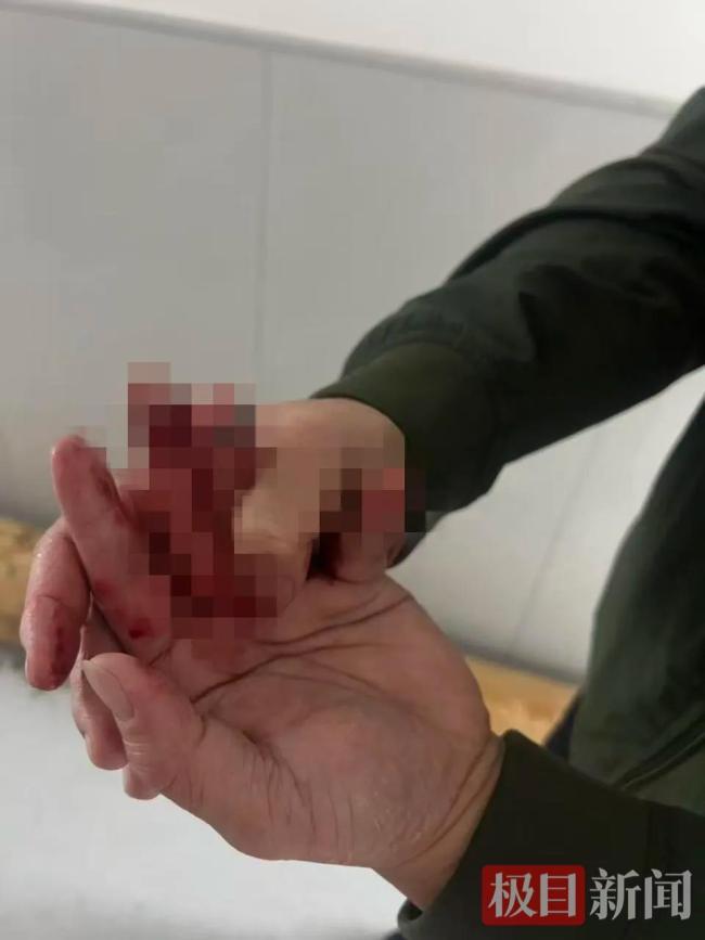 退役军人手指被夹断强撑救出2人 军人血性彰显英雄本色