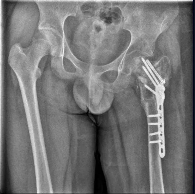 男孩被送矫正基地致半残疾 4人被起诉 虚假宣传的代价