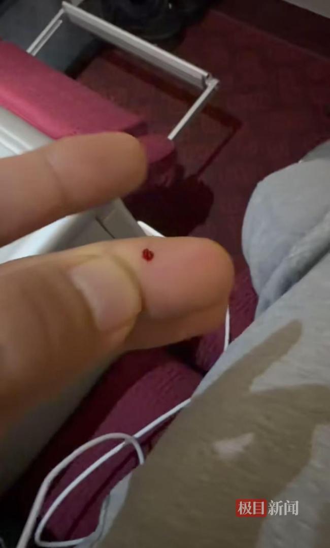 航空公司回应男子头等舱被扎出血 赔偿协商未果