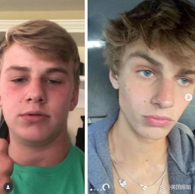 美国男博主因变帅教学走红 容貌极致化引领潮流