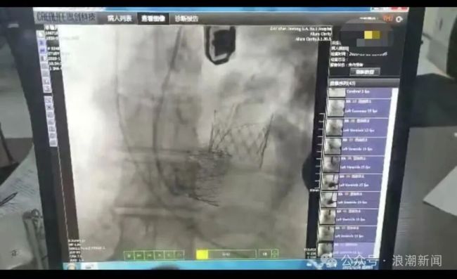 西安交大一附院再曝“瓣膜谜团” 家属质疑收费与知情权