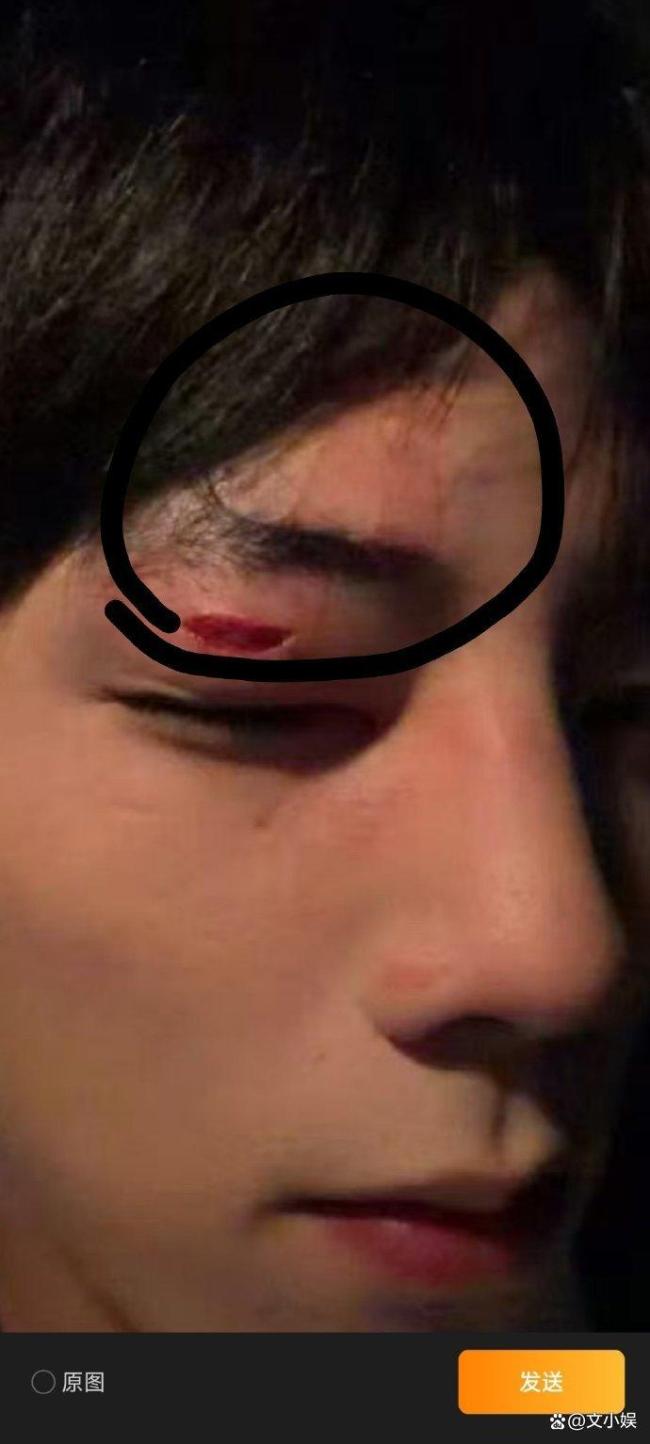 短剧被真打演员报平安 片场意外引关注