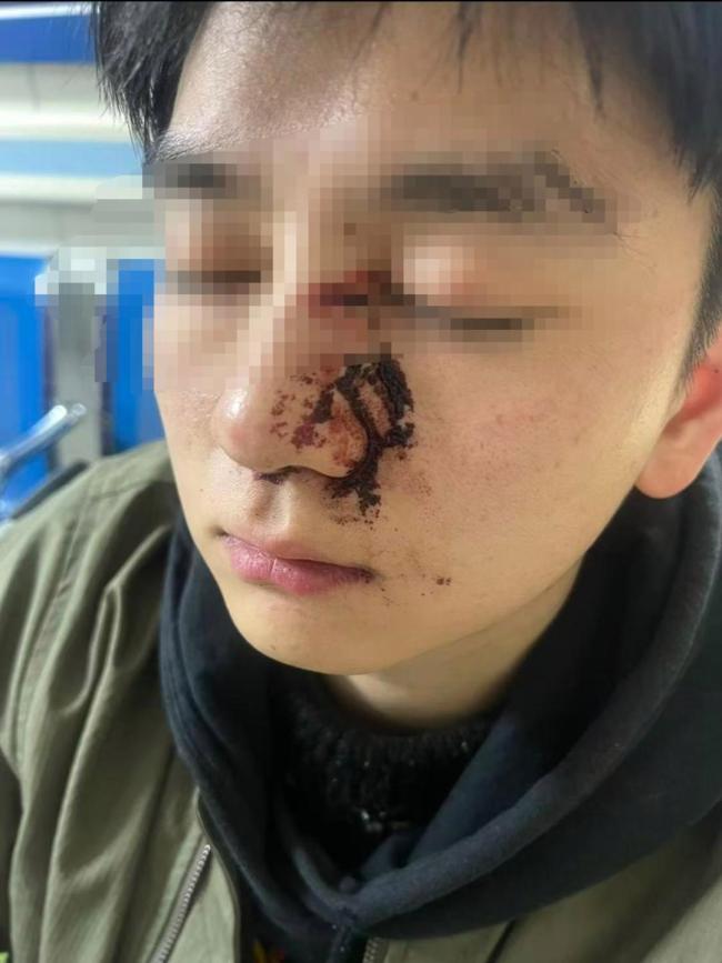 男子因质问遛狗不牵绳被打案二审 维持原判