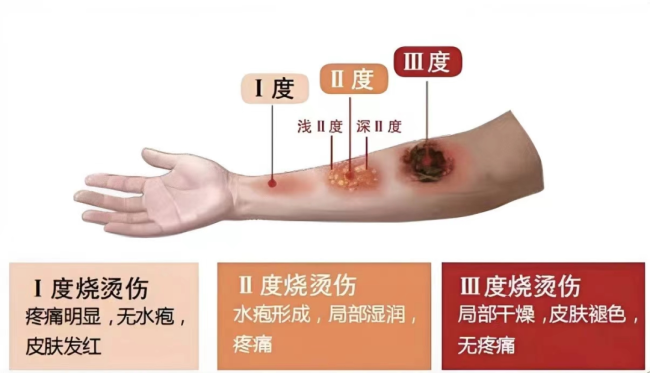 一入锅就炸了,小心这些美味秒变油锅“炸弹”!