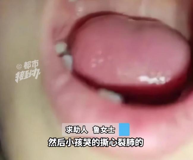 6歲女童撞上“隱形殺手”當(dāng)場倒地 醫(yī)院鐵絲未設(shè)警示標(biāo)志