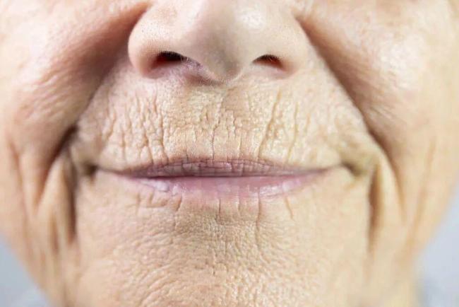 血管堵不堵 看脸和腿就知道?6个信号别忽视