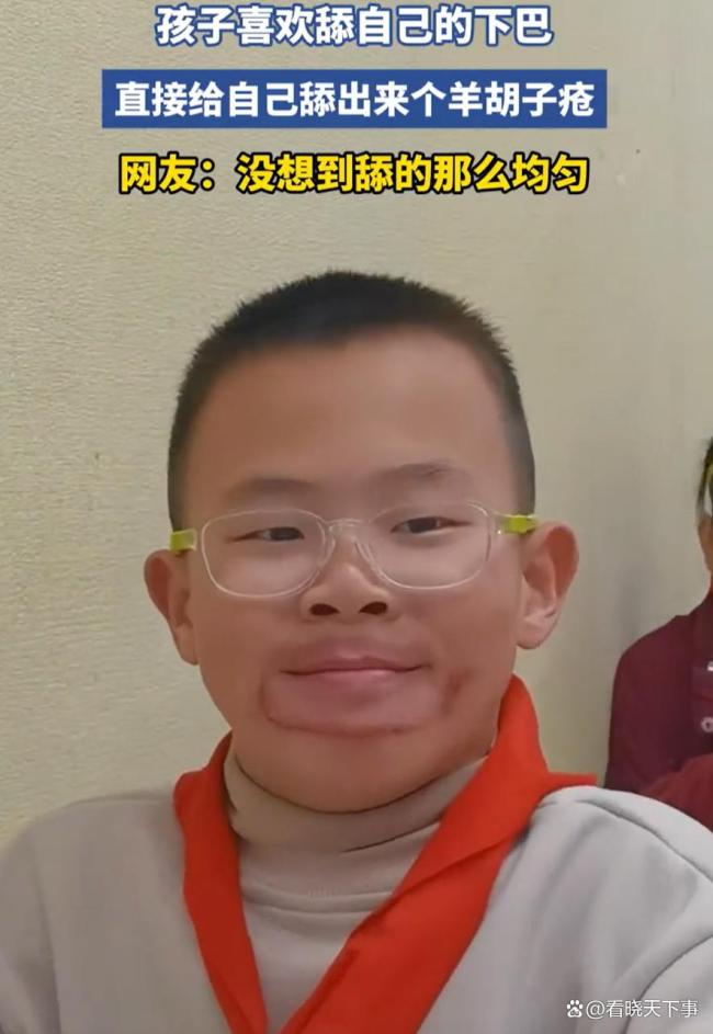 小孩哥舔下巴给自己舔出羊胡子疮