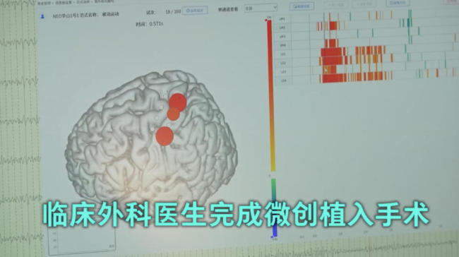 新賽道"領(lǐng)跑"！這些國產(chǎn)硬核科技繪就未來產(chǎn)業(yè)圖景