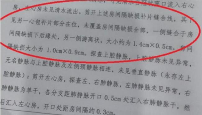 小洛熙无冠状窦型房缺 医疗纠纷引关注