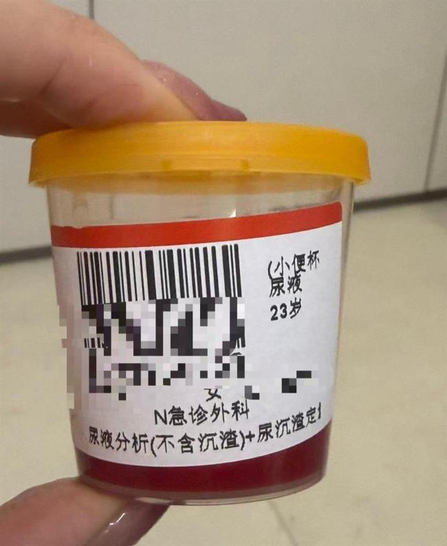 女子称在豪华酒店泡温泉后尿血