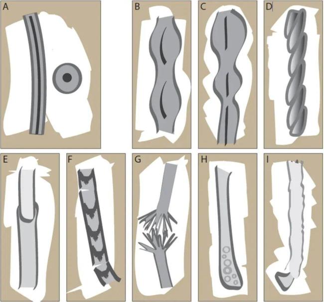 头发开叉其实是种病 警惕毛干异常信号