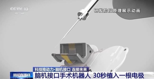 当脑机接口走入生活 会为我们带来哪些新可能？