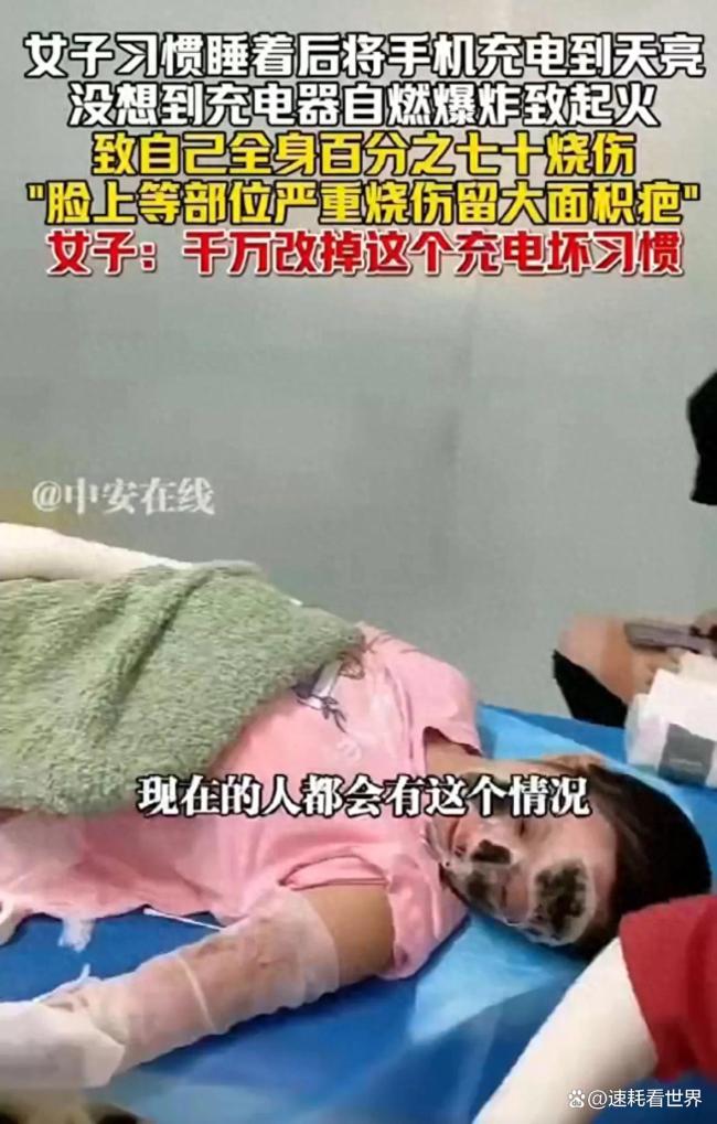 女子深夜手机充电引发火灾,严重烧伤悲剧曝光