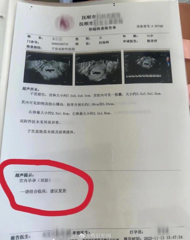 辽宁一孕妇两个月内从一胎变四胞胎 罕见同卵四胞胎引关注