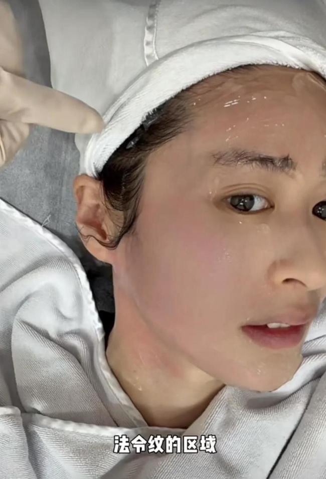 颖儿做眼部热玛吉疼哭了 明星的美丽代价