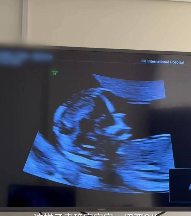 程晓玥自曝二胎孕期食量惊东谈主 周折后的幸福期待