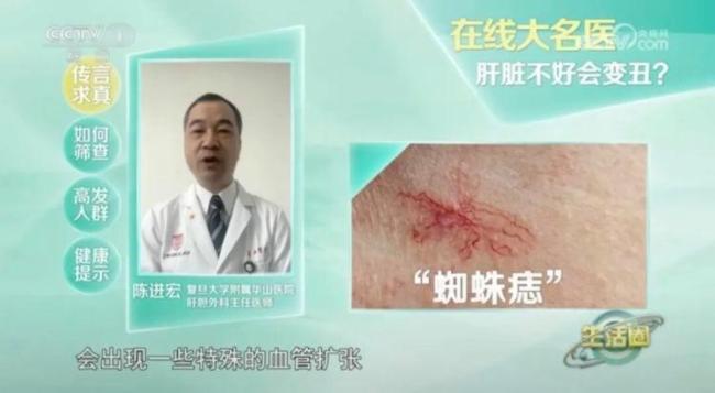 这种面相可能是『肿瘤』前兆 警惕身体发出的警报