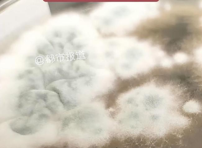 6岁女童发烧17天意识不清，脑子竟被“啃”出十几个洞 烟曲霉菌作祟