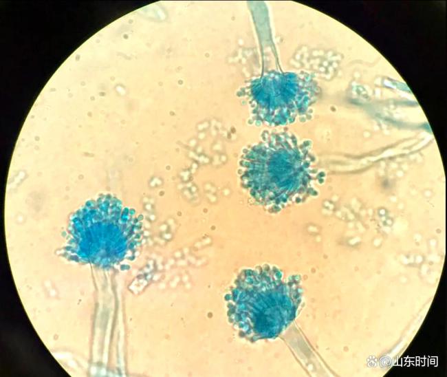 6��Ů������ù��Ⱦ���ӱ���20���� ��ͥ��ʪ�������������