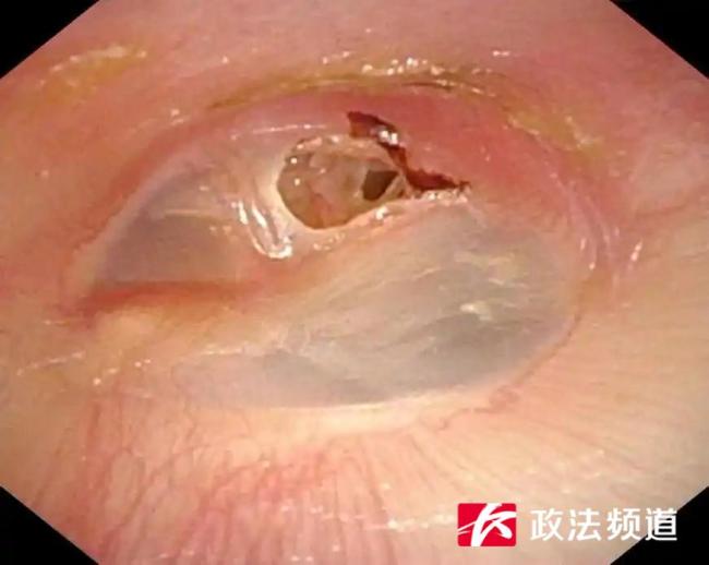 勾搭功课时不悦一掌冲破11岁娃饱读膜