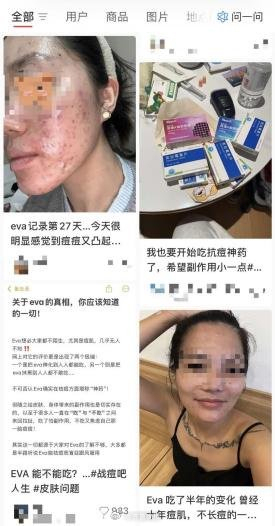 网红战痘神药副作用竟影响性功能 药品说明需全面警示