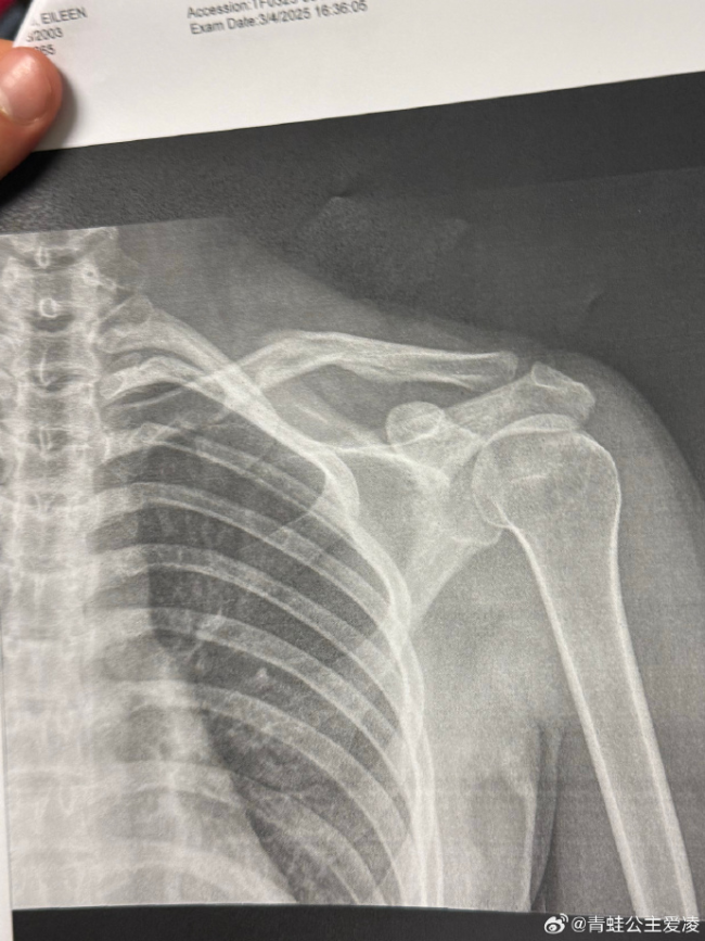 谷爱凌回忆此前重伤落泪 伤痛与坚执背后的爱重