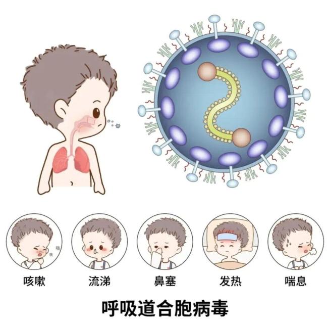 网红“沐言”感染合胞病毒 儿童健康警钟响起