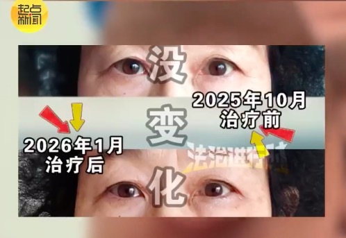 老东说念主花680元祛眼袋被连环骗取十几万 家属：已向法院告状