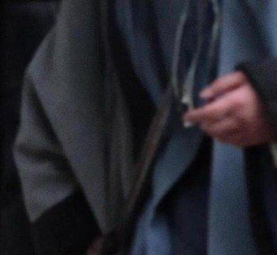 杨洋复工手还肿着